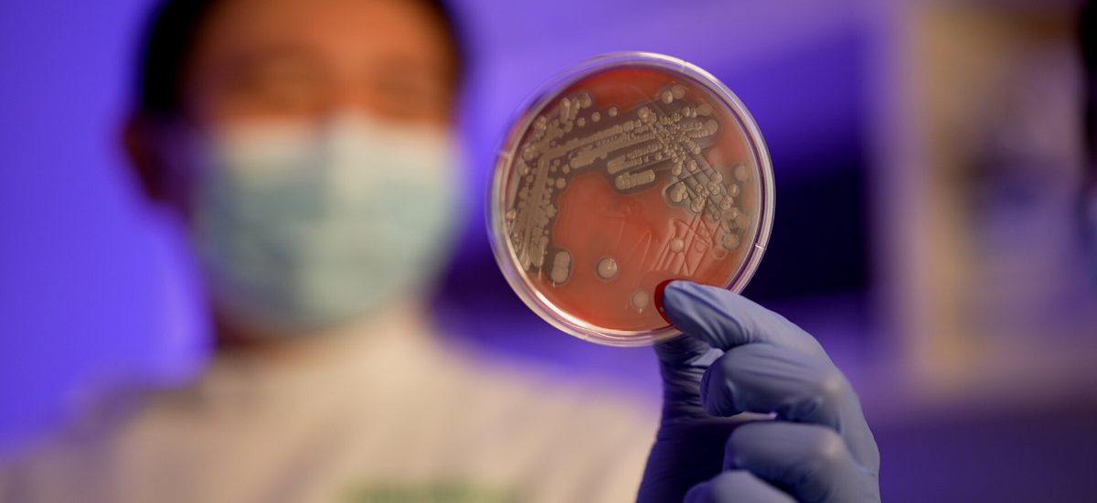 New bacteria species identified, named by Singapore scientists