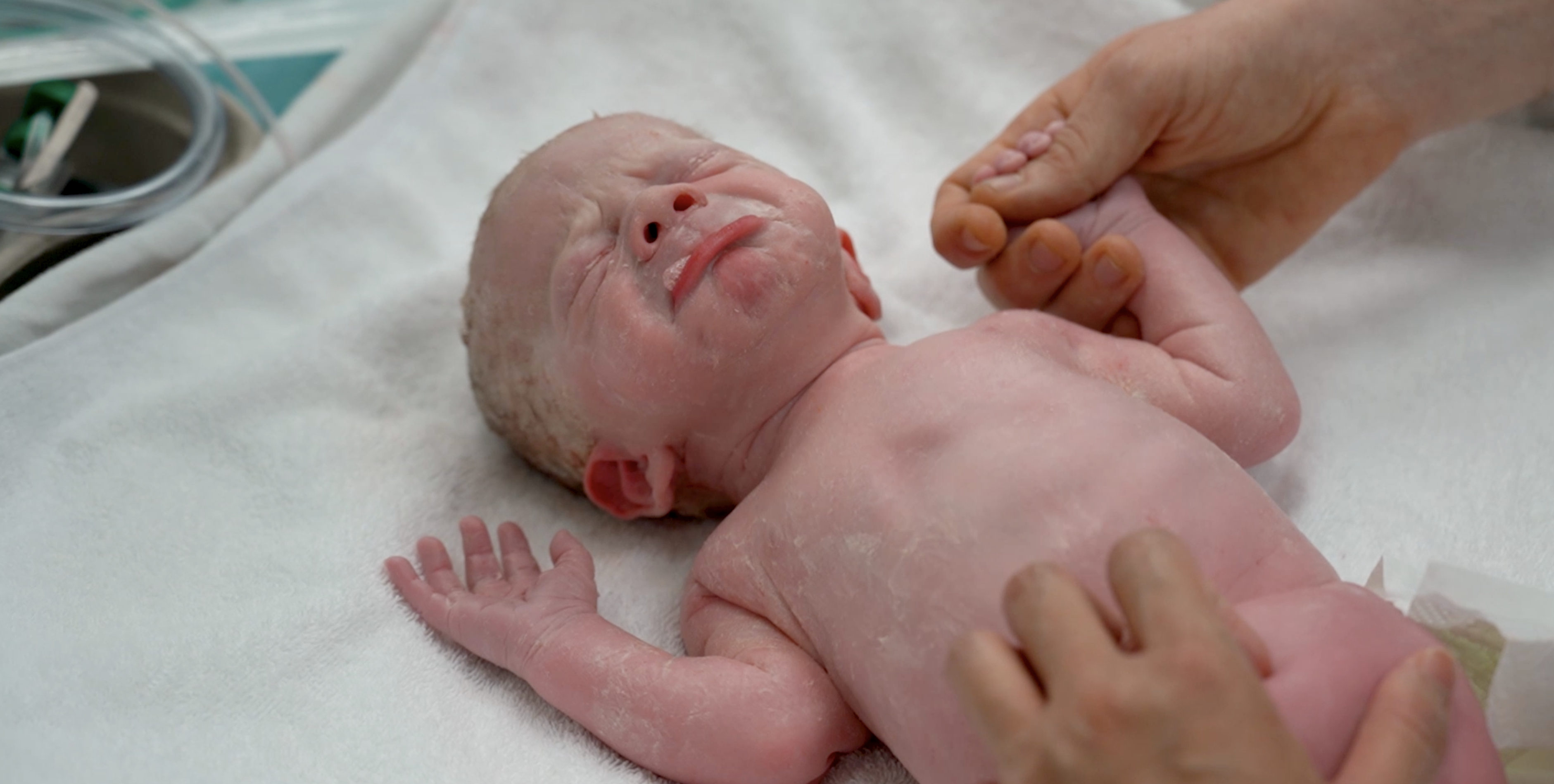 What happens when you go for a C-section?