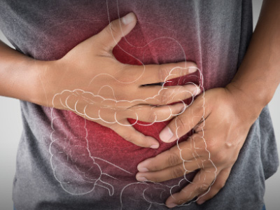 Bowel prep and perceived cost are deterrents to colonoscopy: study