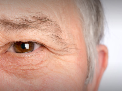 Diabetic retinopathy: How regular screening prevents vision loss