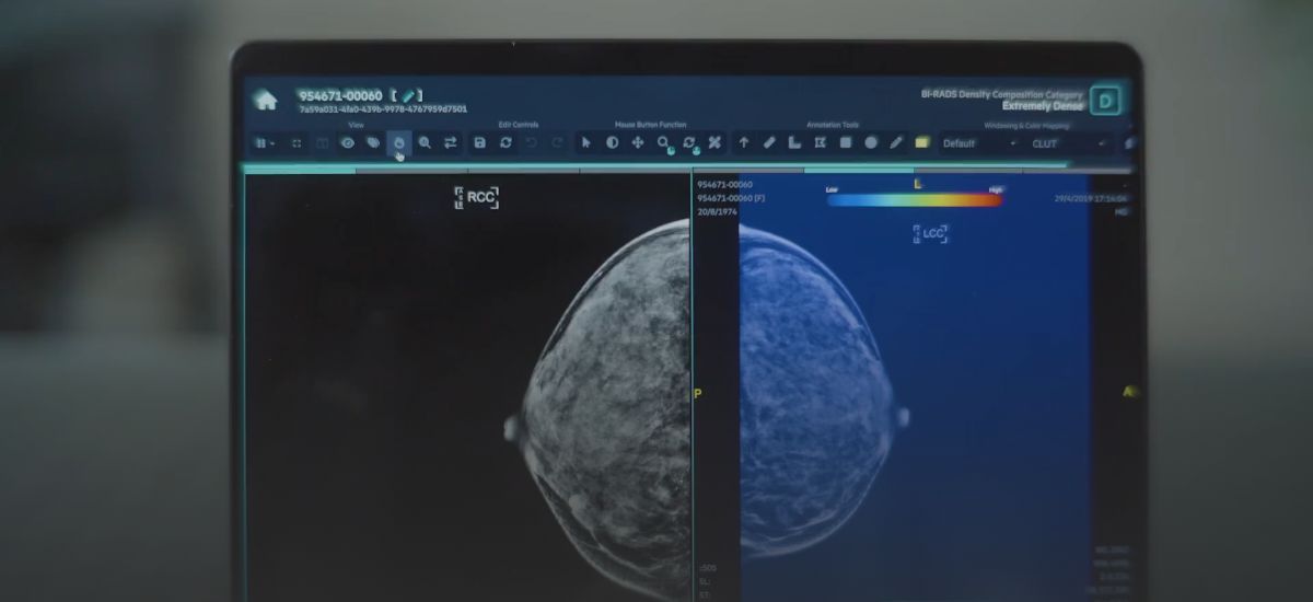 How deep tech is revolutionising mammogram screening