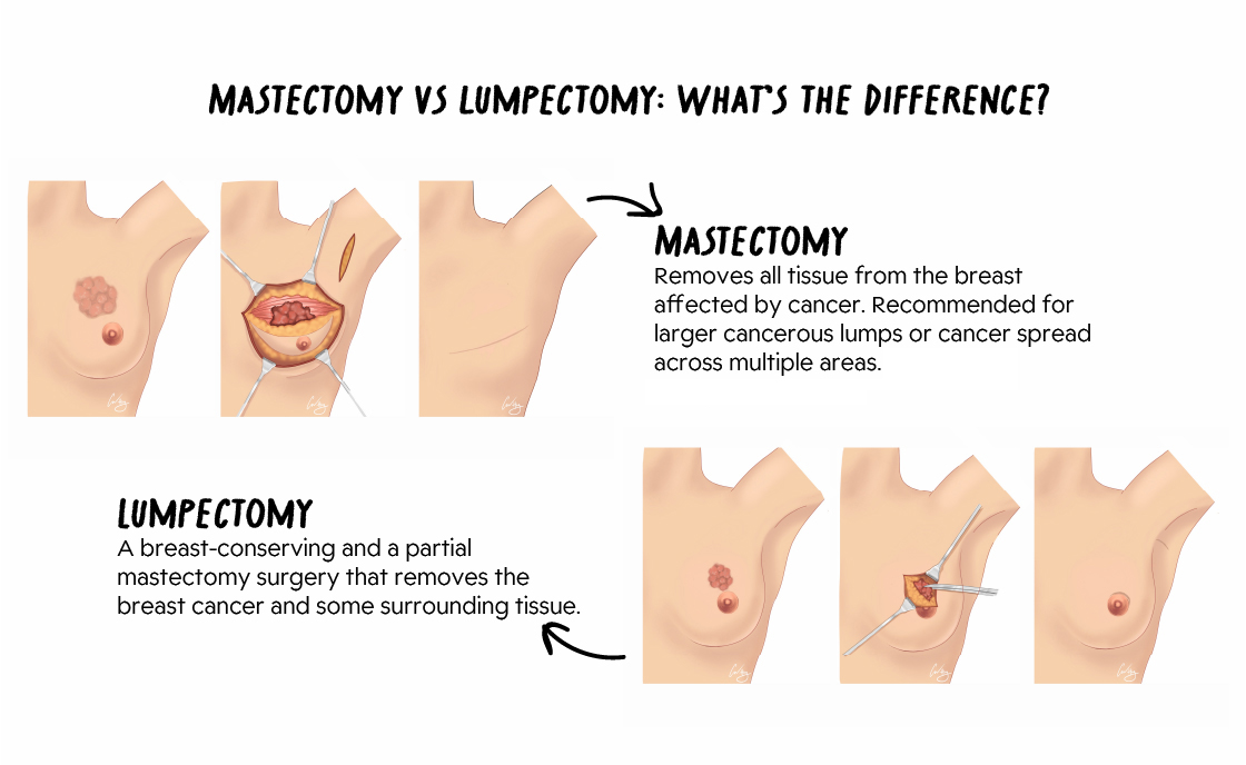 Check Your Breasts In 3 Simple Steps