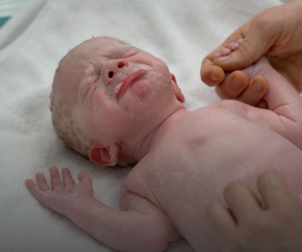What happens when you go for a C-section?