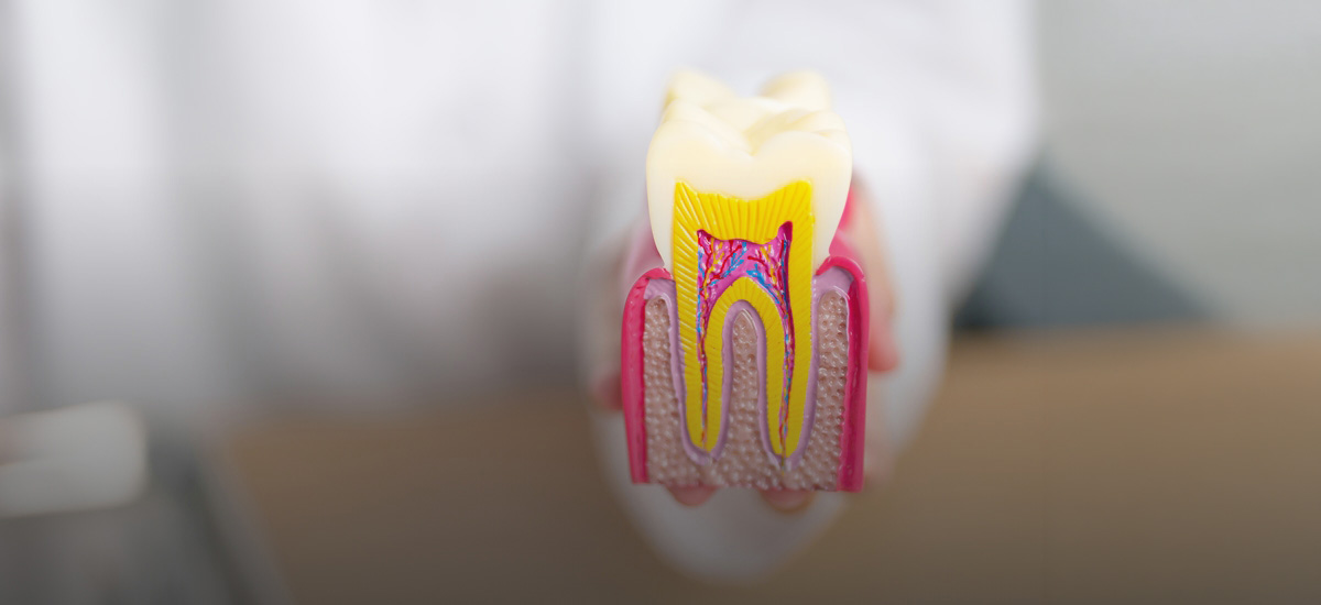 Wisdom tooth surgery: what patients can expect