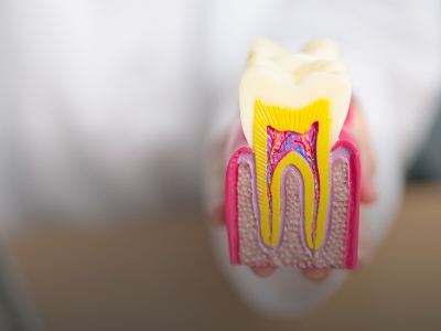 Wisdom tooth surgery: what patients can expect