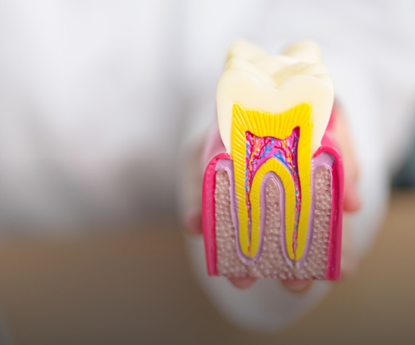 Wisdom tooth surgery: what patients can expect